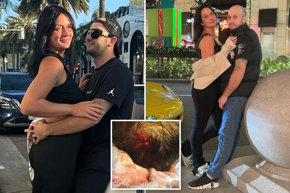 Olympic Hockey Star's Life Shattered by Freak Accident: A Shocking Lawsuit Unfolds