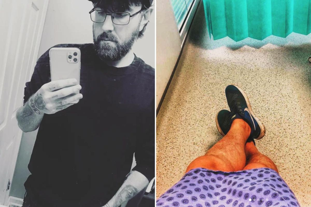Why Michael Phillips' Micropenis Journey Is Captivating the Internet