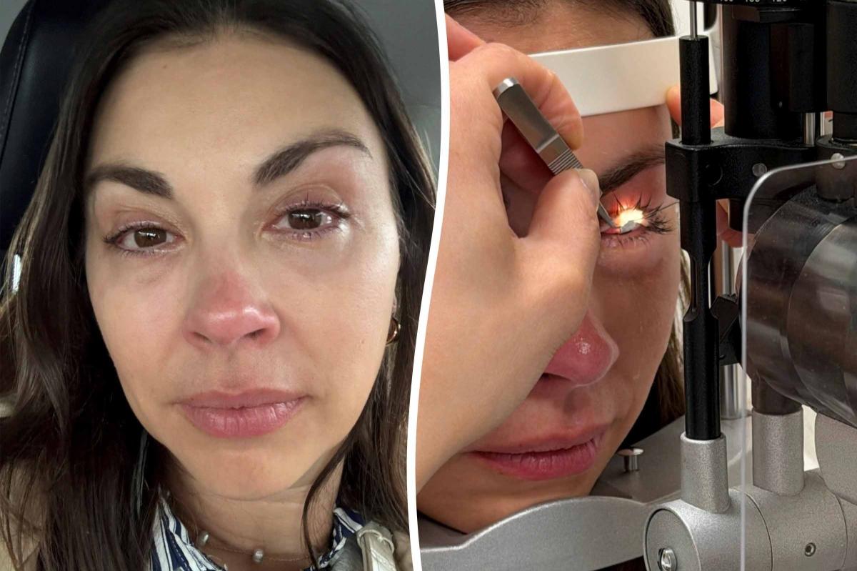 Mom's 20-Year Makeup Habit Leads to Debilitating Eye Condition