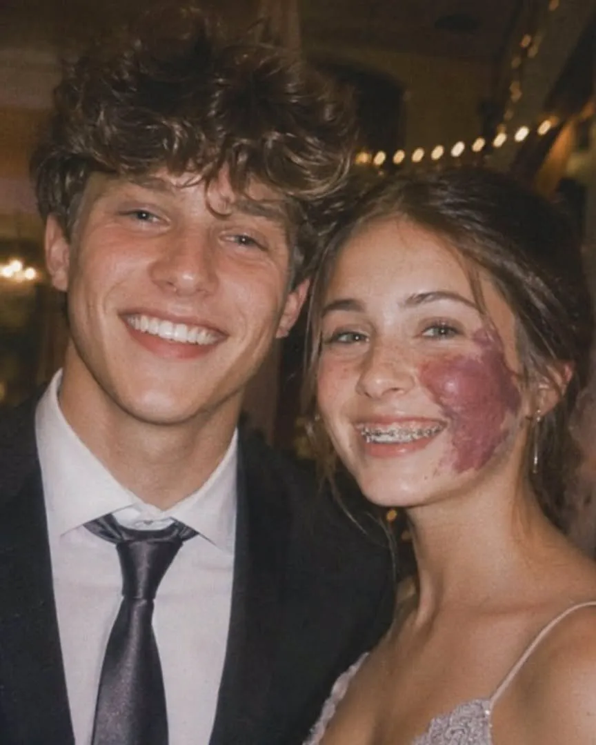Why Hannah's Birthmark Became the Key to Her Past
