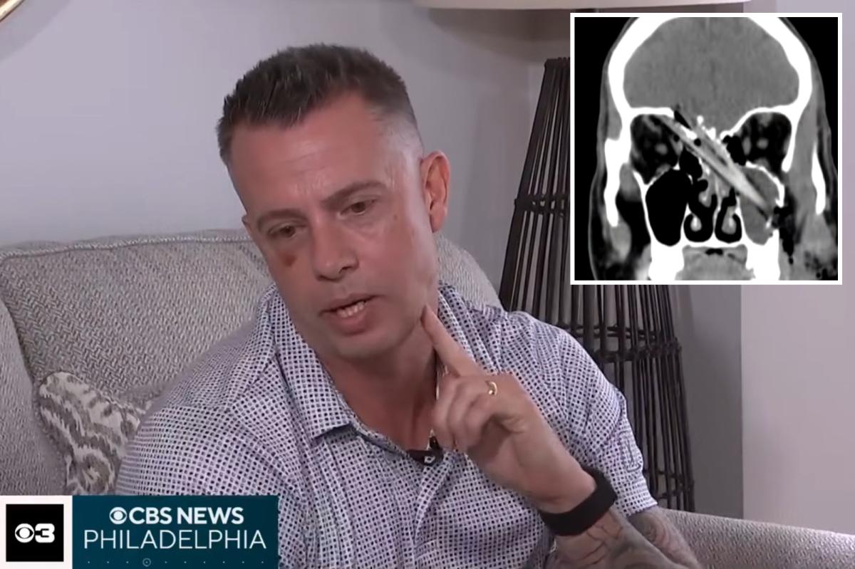 New Jersey Dad's Unbelievable Escape After Tree Branch Impales His Brain