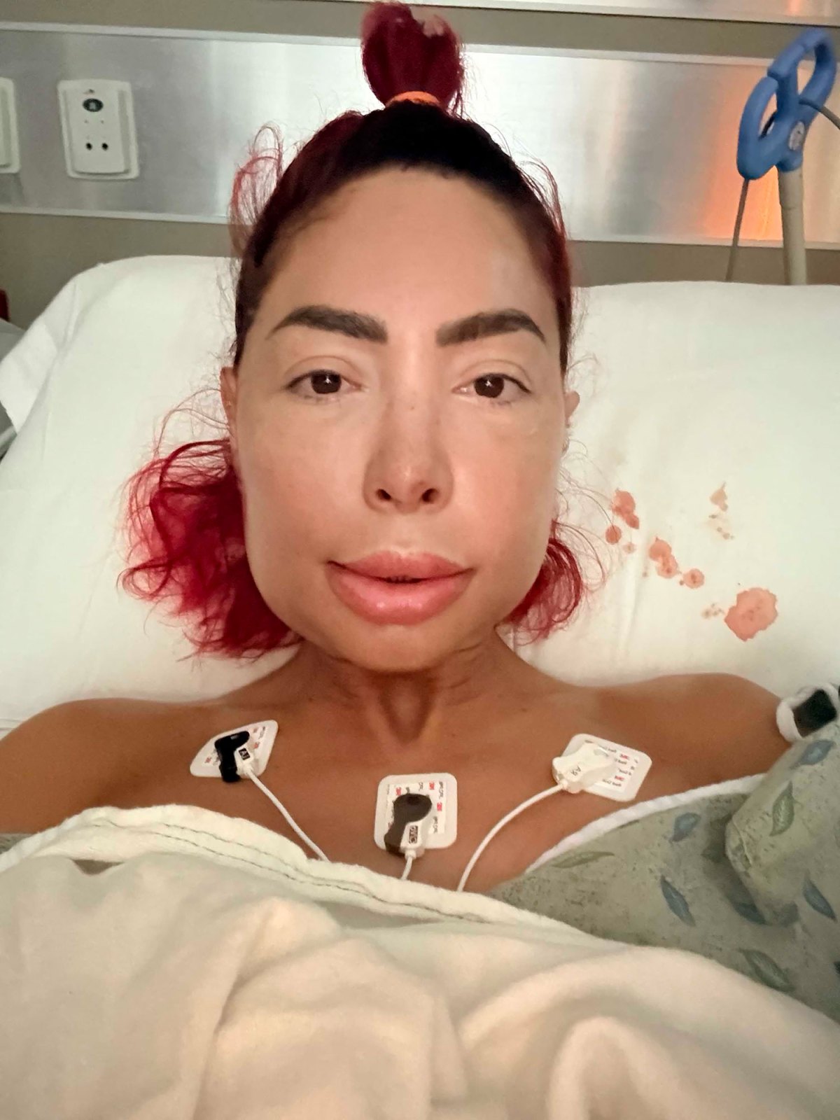 Farrah Abraham's Jaw Surgery Struggle: Why Fans Are Concerned
